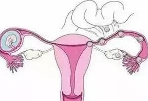 一个女人为什么会得妇科病,10个女人9个有妇科炎症这是为什么