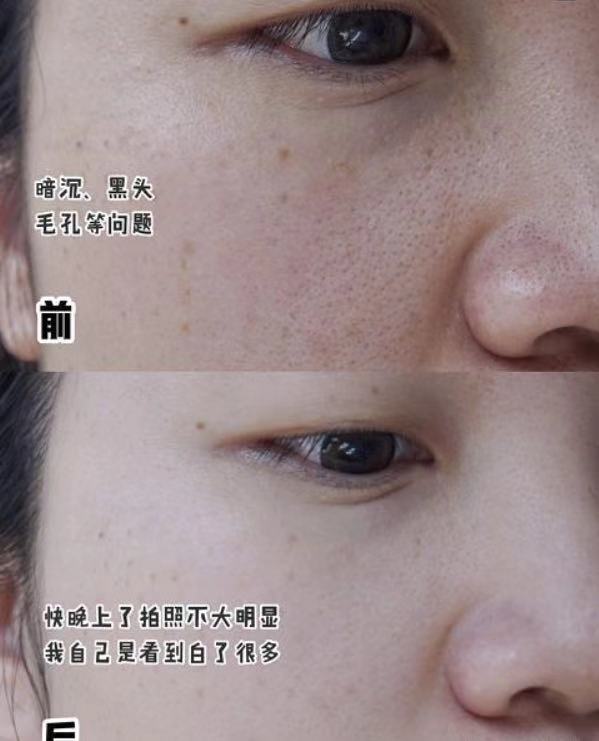 美容黑幕,美容仪内幕大揭秘