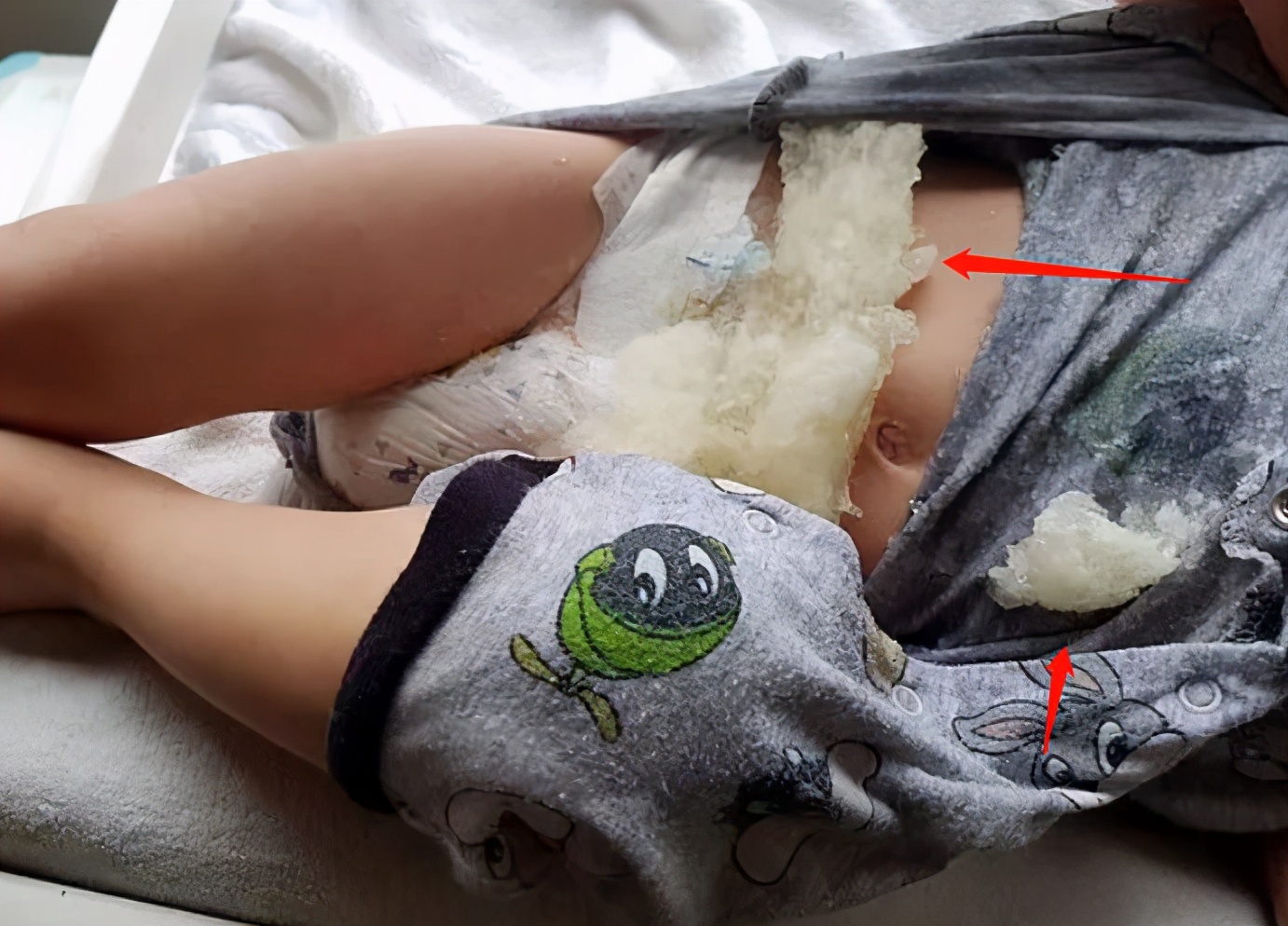 宝宝用尿不湿视频,宝宝用剩的尿不湿请别扔