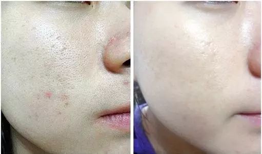 小黄瓜美白面霜,小黄瓜面霜适合皮肤