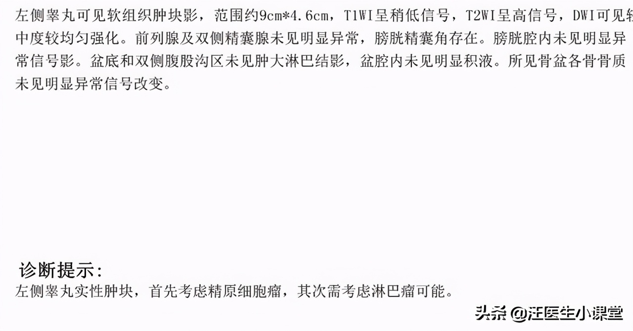 男的睾丸旁边有小肿瘤是什么原因,男性睾丸有小疙瘩越来越大