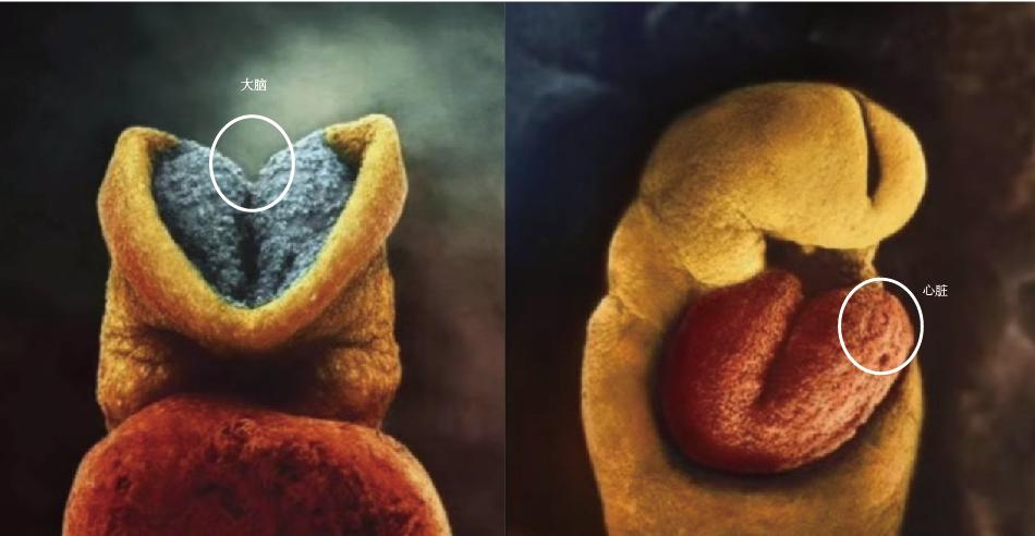 一个婴儿诞生的全过程,婴儿诞生全过程视频