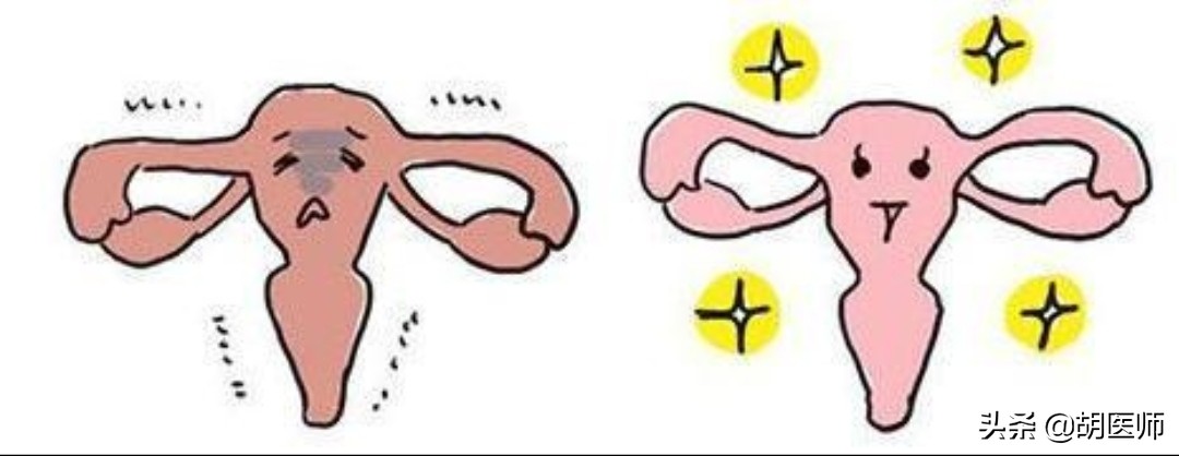 盆腔炎、子宫肌瘤、输卵管肿胀、子宫内膜炎等医案，妇女福音！