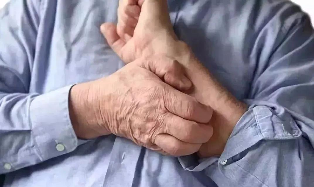 10个月白色糠疹的症状和治疗,圈状糠疹