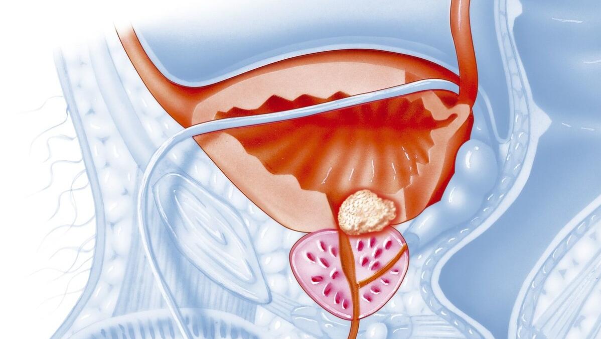 导致尿黄的各种原因,解小便感到小便烫是什么原因