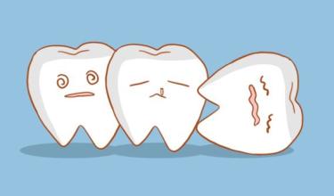 洗牙后为何会感觉牙缝变大了,洗牙后牙缝变大了怎么回事呢