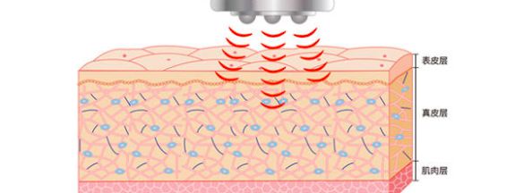 强迫晚婚，控制户口本，当红小花遭极品婆婆在线拆婚！