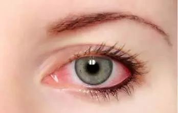 景甜同款洗眼睛水,景甜推荐的网红洗眼液