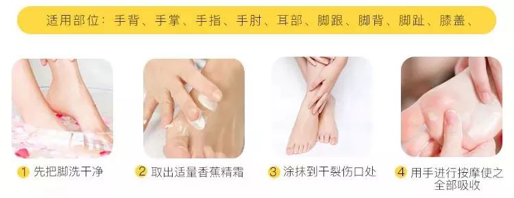 手上冻疮干裂怎么办,手脚冻脸上冻疮三天快速消除