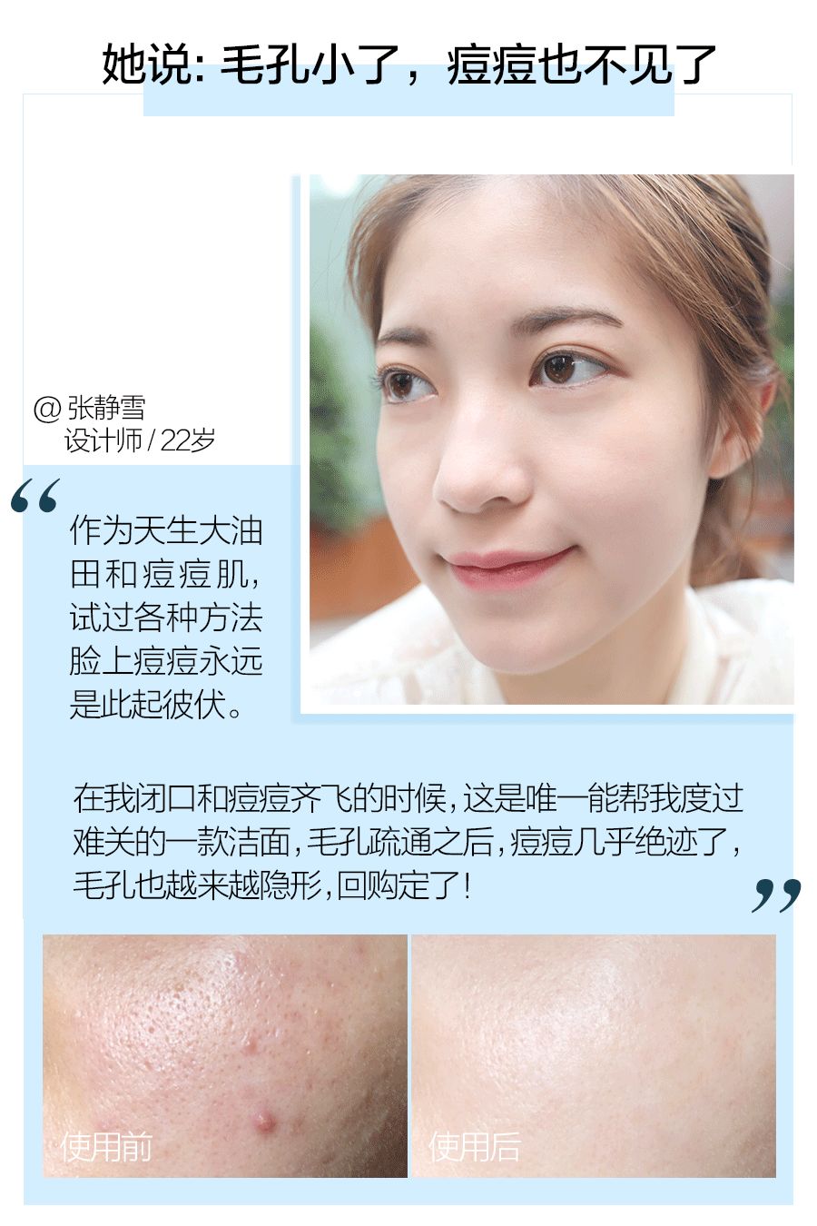 教你这样洗脸,洗脸虽简单也得好好对待