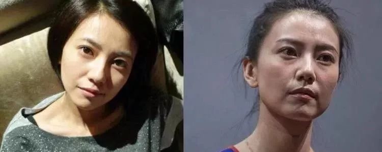 430年马应龙非遗中药眼膜，保密古方，一敷秒去大眼袋