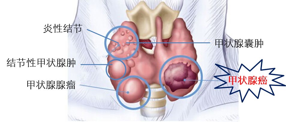 甲府事件真假,甲府事件可信度