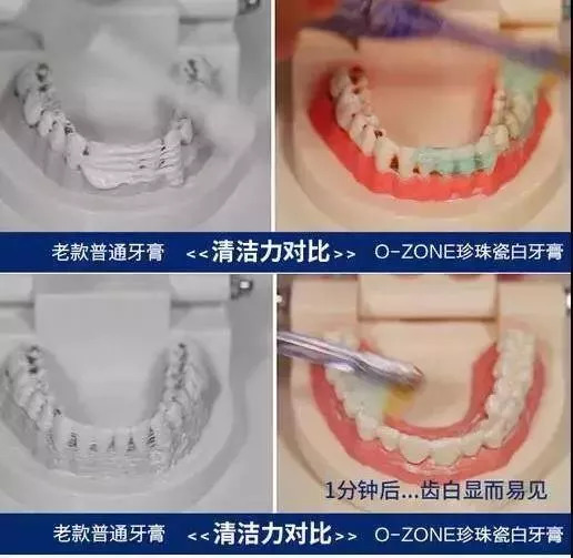 专治牙黄口臭超好用牙膏明星同款,牙膏测评美白去黄清新口气第一名