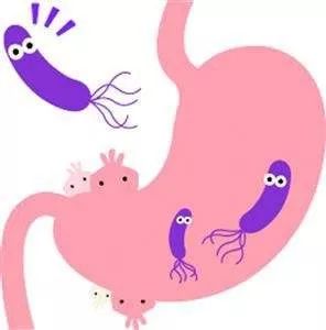 幽门螺杆菌igm抗体阴性但igg阳性,体检查出幽门螺杆菌呈阳性怎么办