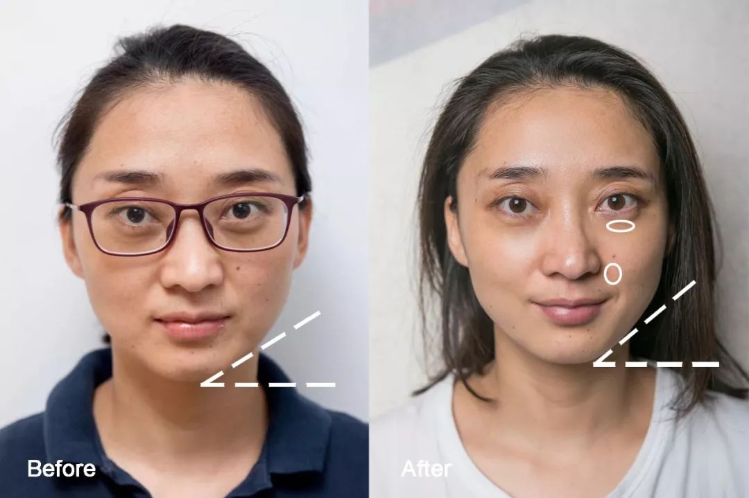 灏忚寕鑲岃瘖瀹ゅ埌搴曟湁澶氬己,灏忚寕鑲岃瘖瀹よˉ姘村悧