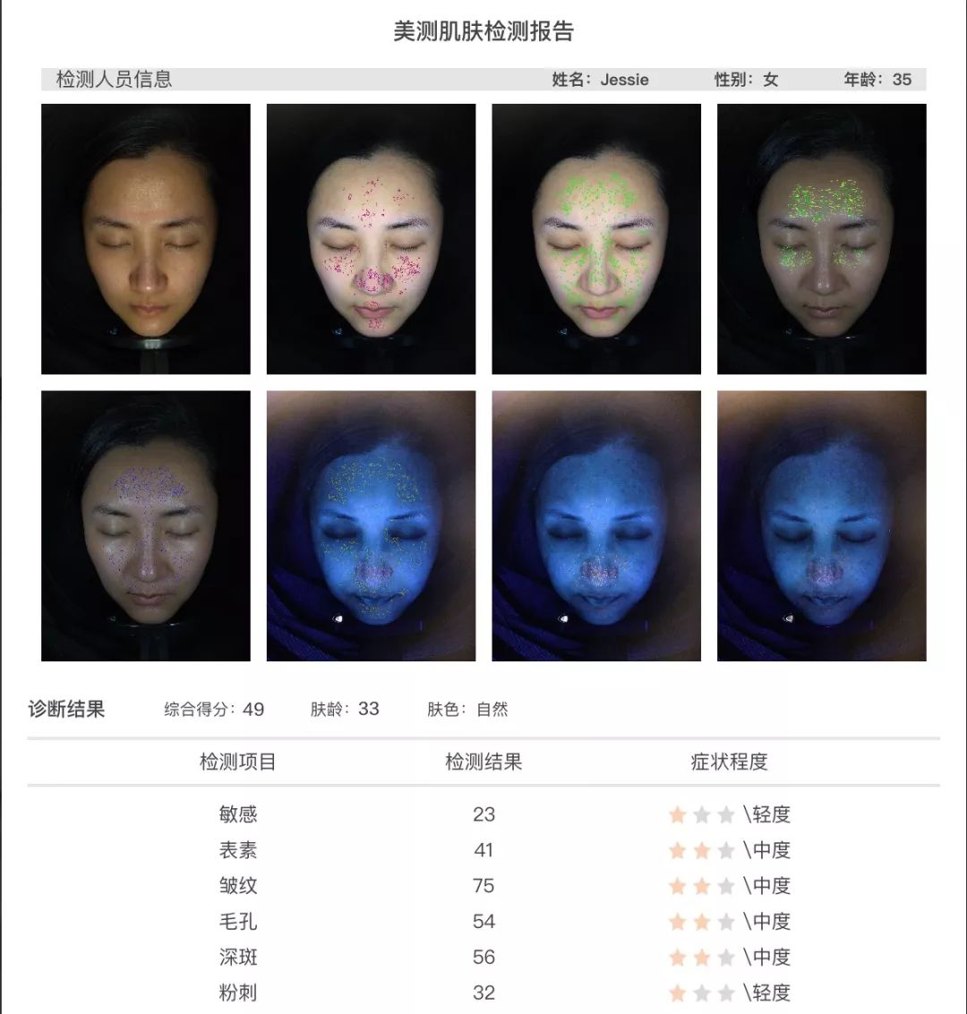 灏忚寕鑲岃瘖瀹ゅ埌搴曟湁澶氬己,灏忚寕鑲岃瘖瀹よˉ姘村悧