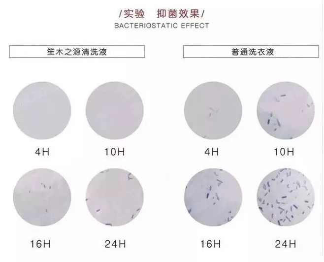 瘙痒难忍、有异味、反复发作，是你这里出了问题！