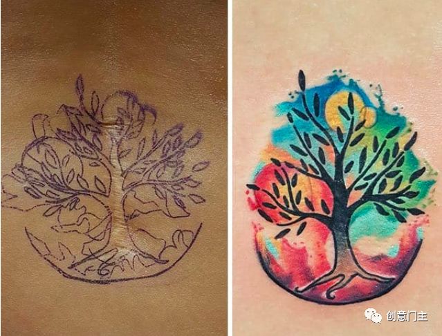 去除纹身疤痕最好的方法,疤痕纹身怎么去除