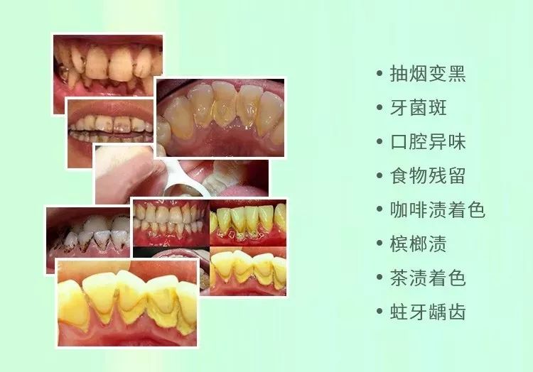 闭着嘴巴一直有口水,闭着嘴巴往外呼气的时候有臭味