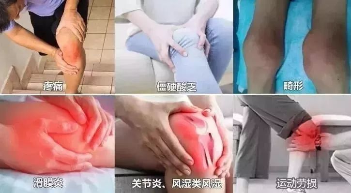 冬季护膝保暖老寒腿,很好用的保暖护膝避免老寒腿