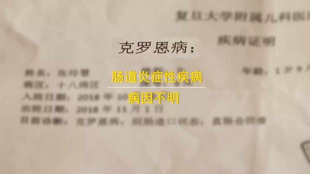 一岁女孩患18种罕见病,女童身患多种罕见病医生不敢治