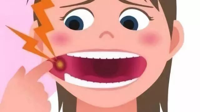 口腔上火西药配方,店员经典培训教材