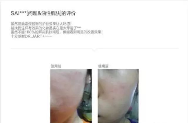 一支“激光霜”帮你解决众多困扰~