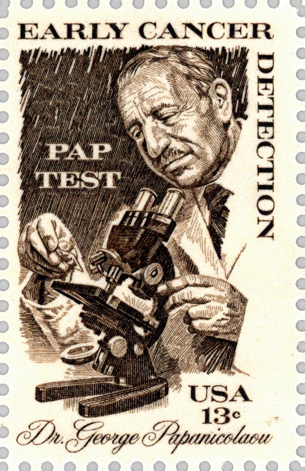 宫颈刮片报告,宫颈刮片检查报告