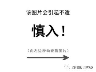 9岁小孩双肾长满结石,9岁男娃尿血肾脏竟取出