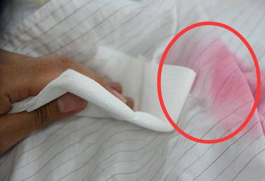 怎样把染色白衣服洗干净,染色严重的衣服怎么洗干净