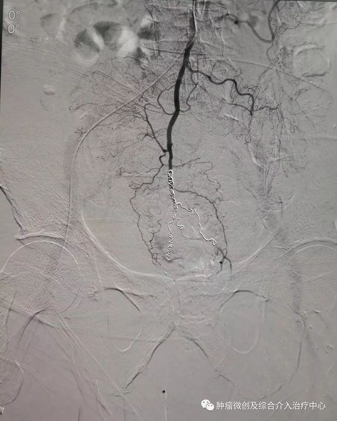 运城市第一医院肿瘤科咋样,运城第一医院治疗肿瘤怎么样