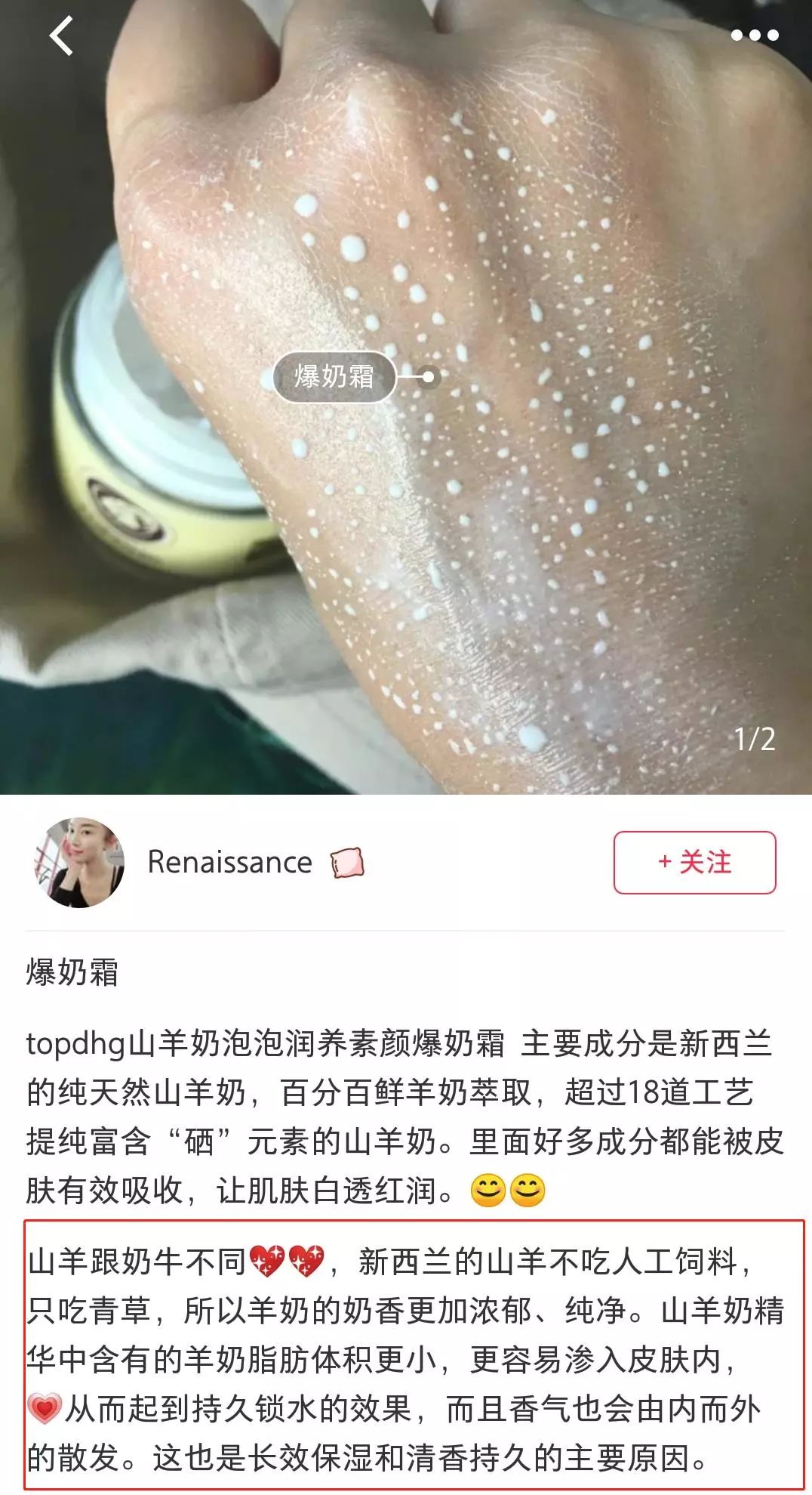 脱发算啥！90后已经开始长“老年斑”了，有人还为此花了10多万！