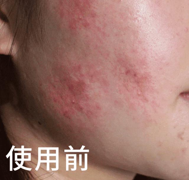 网红抗老面霜,35款网红修护霜