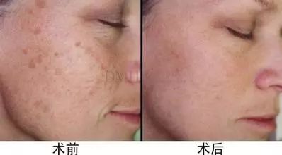 新年新气象从焕新开始,新年新气象开工好彩头