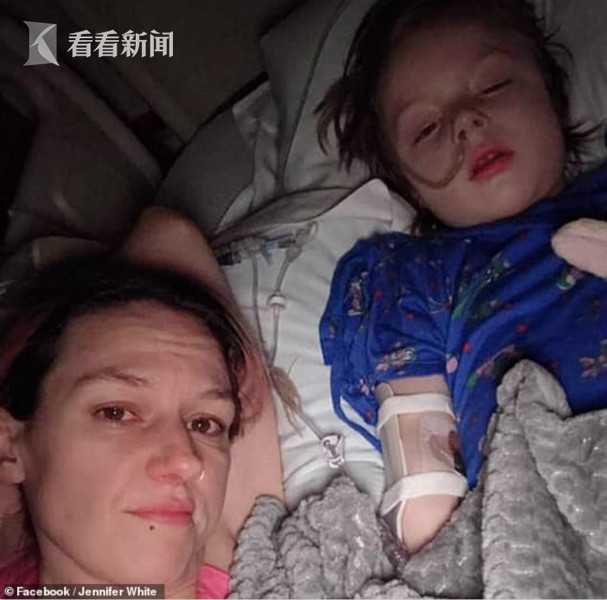 4岁小孩吞塑料积木,四岁熊孩子误吞了34颗磁力珠