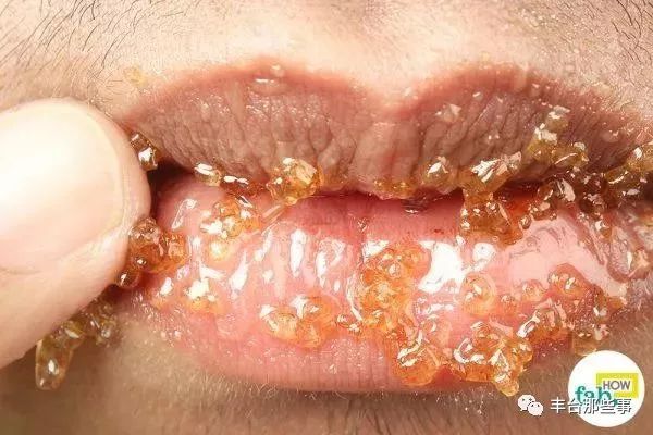 蜂蜜加白醋有效吗,蜂蜜加白醋怎么样