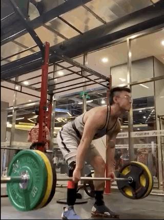 俄罗斯留学生骨折截肢,留学生意外被截肢