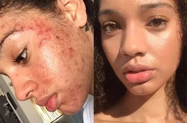 清凉止痒防暑醒神膏,止痒的草药膏