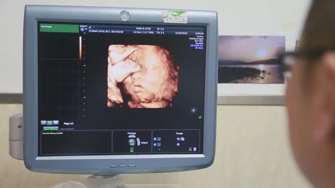 女儿“借”母亲子宫，生下宝宝……这关系以后有点尴尬