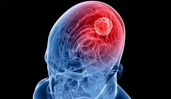 儿童蛛网膜囊肿手术多少钱,椎管内蛛网膜囊肿手术