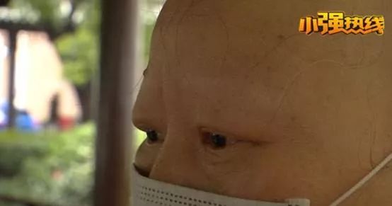 头发睫毛眉毛全部掉光能不能治好,头发睫毛眉毛全部掉光有没有案例