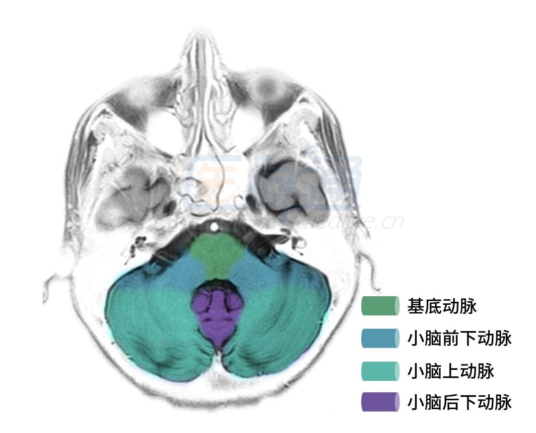 脑动脉供血区域图谱,脑各分支动脉供血区域示意图