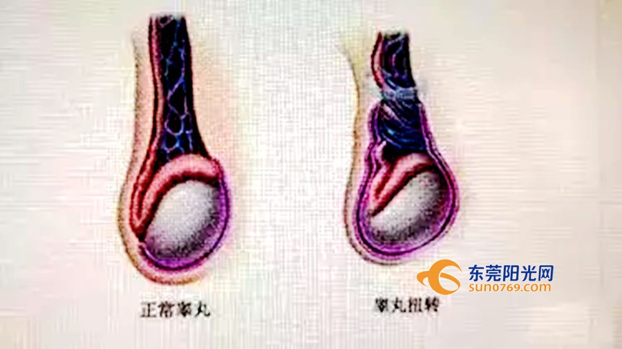 12岁小孩关节酸痛是什么原因,青少年出现身体各处疼痛
