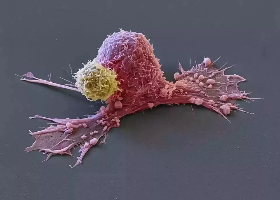 她拥有永生,靠此造福10亿人,死于癌症后,她的细胞带她重生!