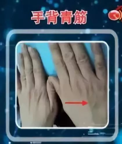 手上的青筋突然暴起代表什么意思,孩子吓到了手上有青筋是怎么回事
