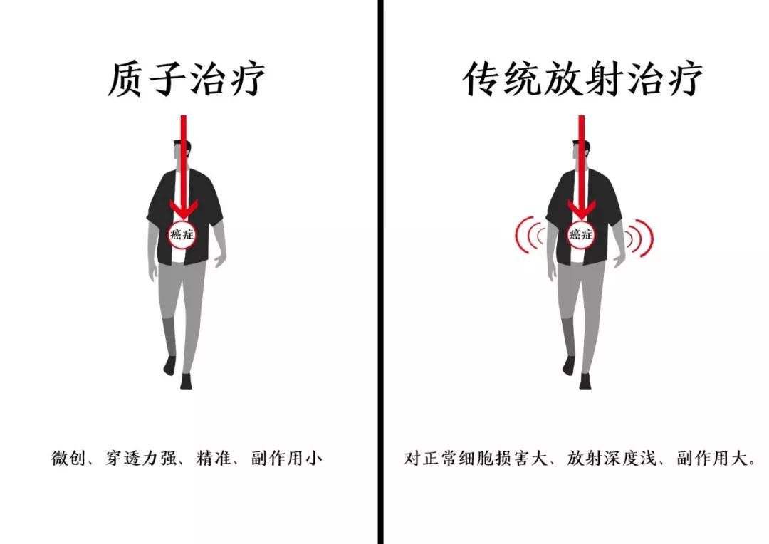 四川华西医院治疗癌症试验成功,四川华西医院治疗癌症怎么样