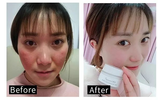 网红抗老面霜,35款网红修护霜