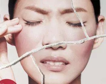 痘印红血丝修复护肤品平价,痘印泛红团购