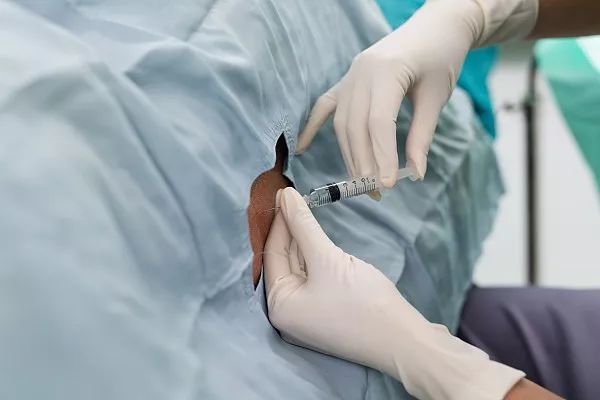 山东无痛分娩试点医院名单,无痛分娩试点医院广东