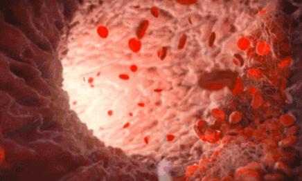 张雨绮猪油抹脸,张雨绮猪油膏